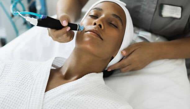 laser hair removal