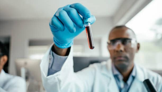 blood test