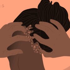 Psoriatic Arthritis Can Feel Beyond Your Control. Consider a Different Direction. Learn More Here.