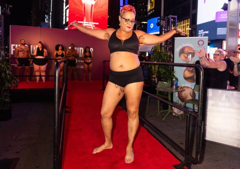 I Walked in Times Square to Show Women with HS They Are Beautiful