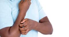 itchy skin, cholesterol