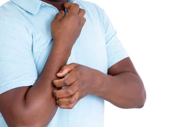 itchy skin, cholesterol