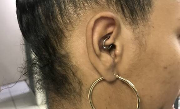Close-up of a daith piercing through the ear cartilage, showing jewelry placement