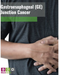 Gastroesophageal (GE) Junction Cancer